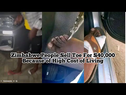 Zimbabwe Selling Toes for Money Amid High Cost of Living - Is it a FAD